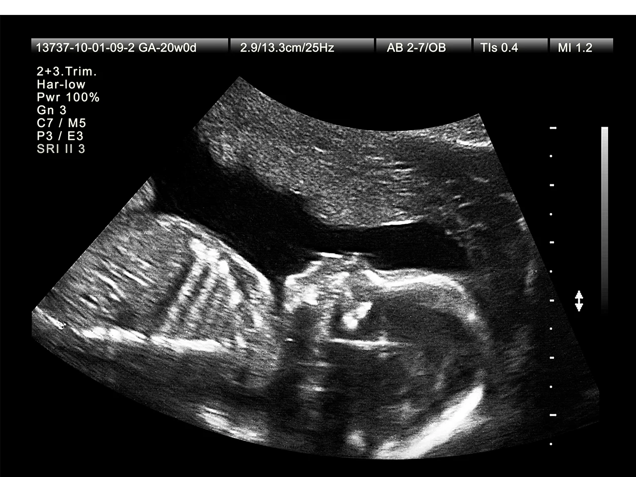 Detaylı ultrason görüntüsü