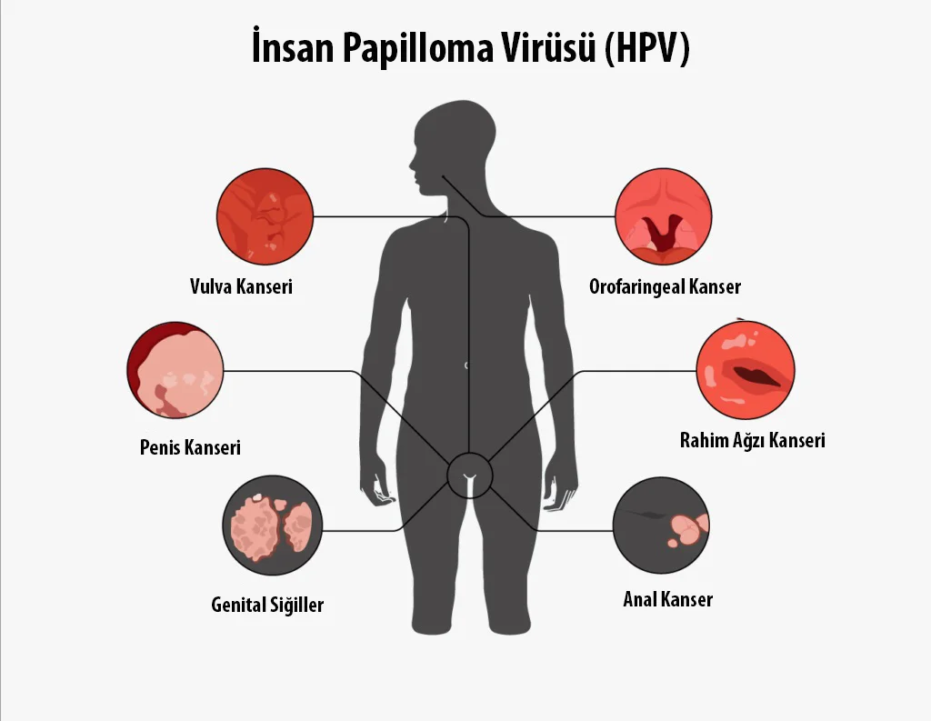 HPV Belirtileri